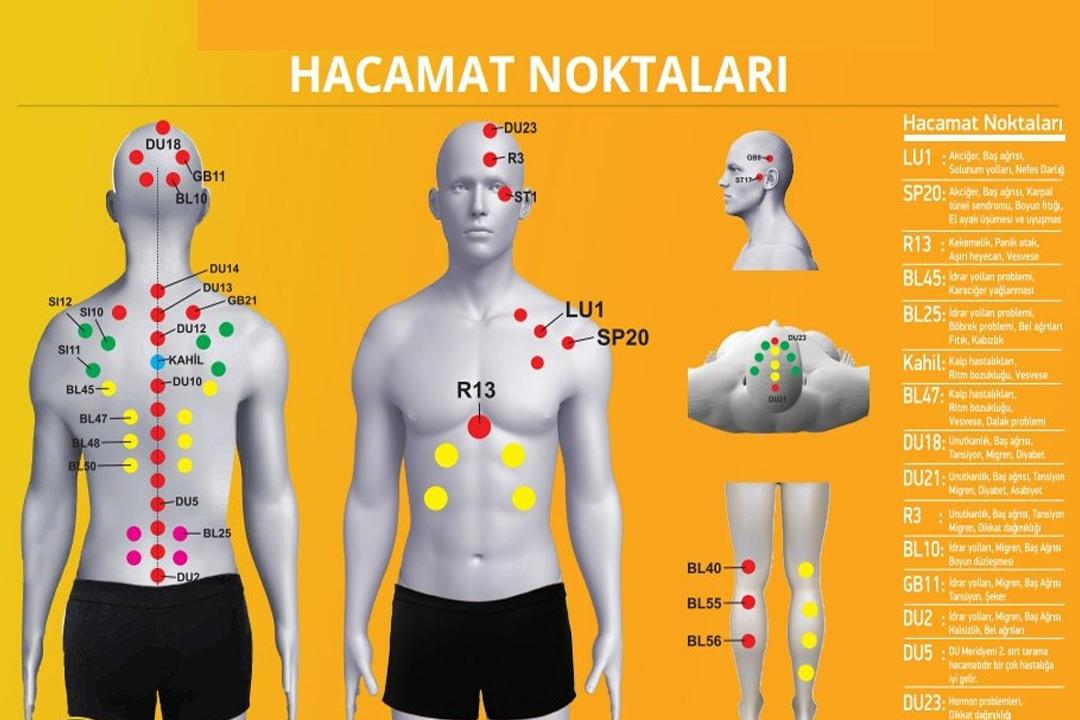 Hacamat hangi hastalıklara iyi gelir? Faydaları nelerdir?