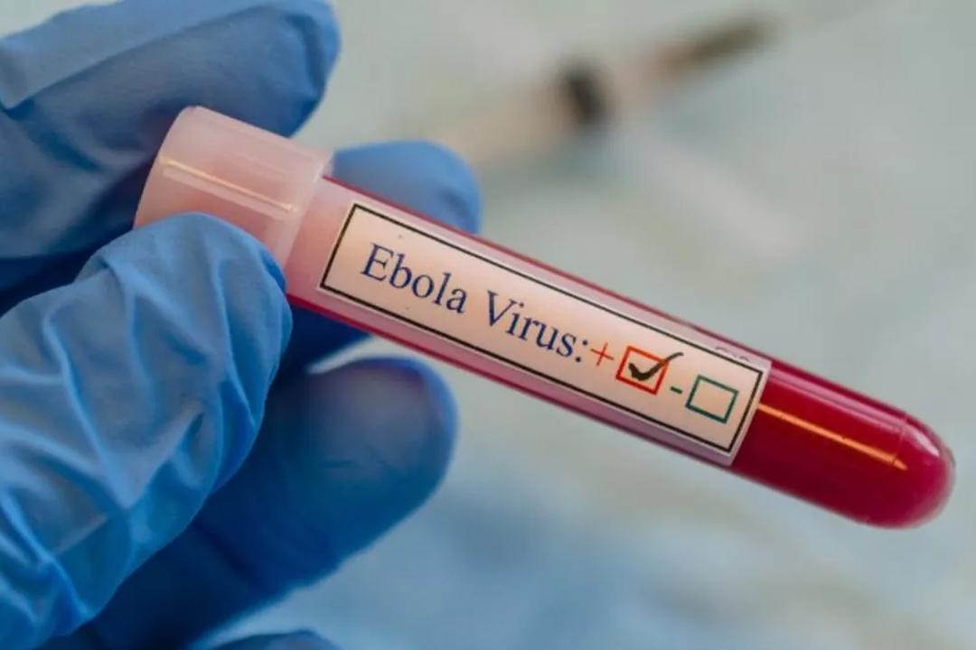 Ebola virüsü nedir? Belirtileri nelerdir? Tedavisi var mı?