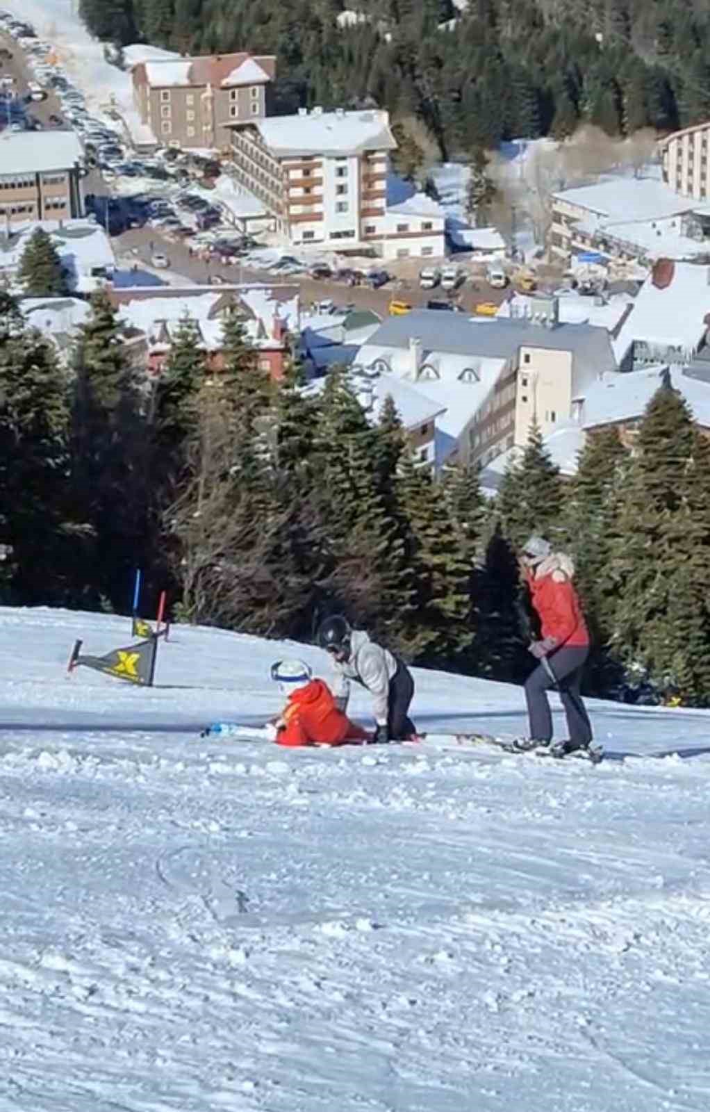 Uludağ’da kazadan dönüldü...Telesiyejin batonu bir turisti yaraladı