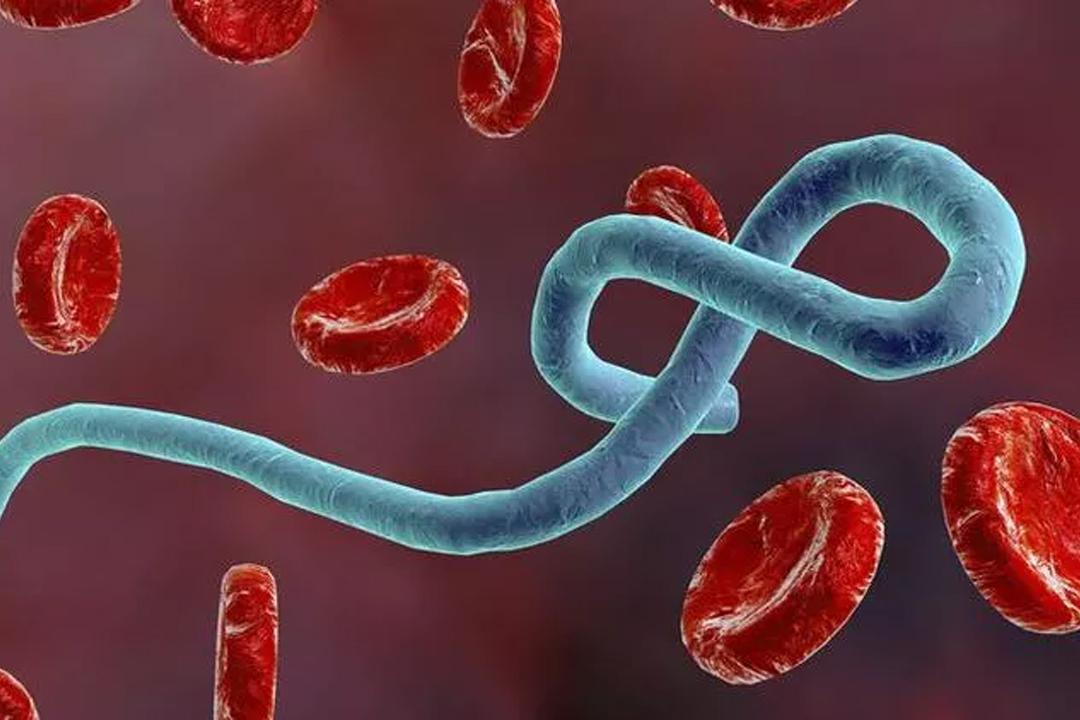 Ebola virüsü nedir? Belirtileri nelerdir? Tedavisi var mı?