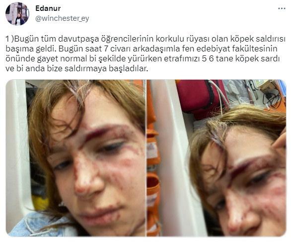 Yıldız Teknik Üniversitesi'nde başıboş köpek rezaleti: Genç kız kafa travması geçirdi!