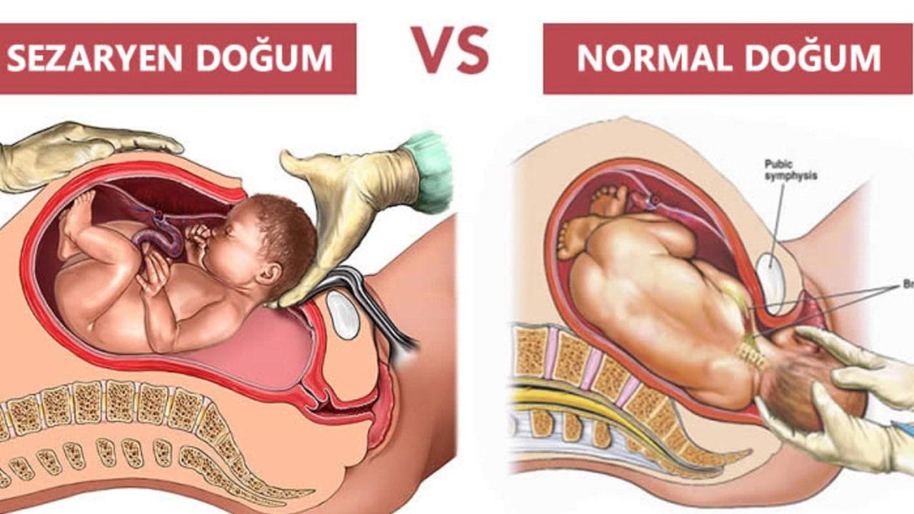 Normal doğumun 10 maddede sağlığa faydaları: Normal doğumun vücuda faydaları